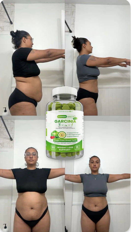 Gummies Garcinia - Perte de poids en 15 jours